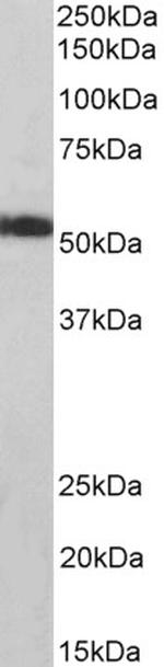 ATP5A1 Antibody in Western Blot (WB)