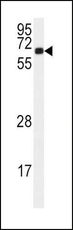 CaMKII alpha Antibody in Western Blot (WB)