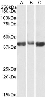 Aldolase A Antibody in Western Blot (WB)