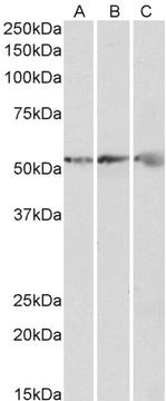 ATP Synthase beta Antibody in Western Blot (WB)