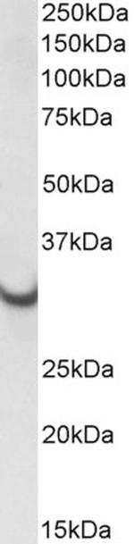 ATP Synthase gamma Antibody in Western Blot (WB)