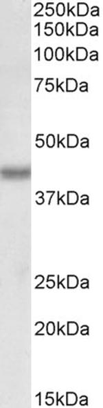 BMI-1 Antibody in Western Blot (WB)