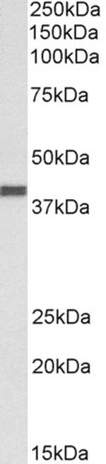 CXCR1 Antibody in Western Blot (WB)