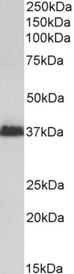 MSI2 Antibody in Western Blot (WB)