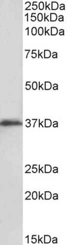 MSI2 Antibody in Western Blot (WB)