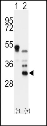 Apolipoprotein D Antibody in Western Blot (WB)