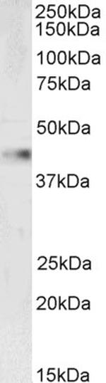 VASP Antibody in Western Blot (WB)