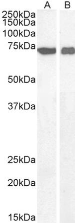 AIF Antibody in Western Blot (WB)