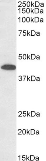 GNA12 Antibody in Western Blot (WB)