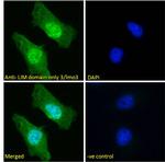 LMO3 Antibody in Immunocytochemistry (ICC/IF)