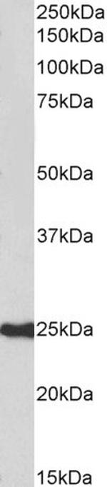 HDGFRP3 Antibody in Western Blot (WB)