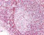 HLA-B Antibody in Immunohistochemistry (Paraffin) (IHC (P))