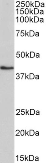 HMBS Antibody in Western Blot (WB)