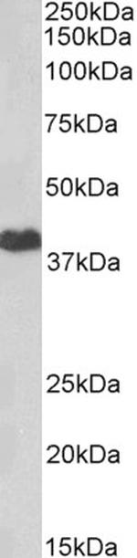 PKA alpha Antibody in Western Blot (WB)