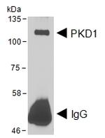 PKC mu Antibody in Western Blot (WB)