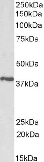 PTGR2 Antibody in Western Blot (WB)