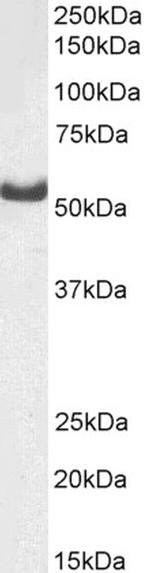 DARS Antibody in Western Blot (WB)