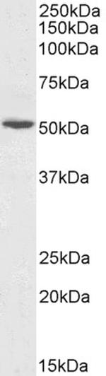 GPT Antibody in Western Blot (WB)