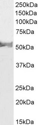 LCAT Antibody in Western Blot (WB)