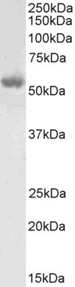 LCAT Antibody in Western Blot (WB)