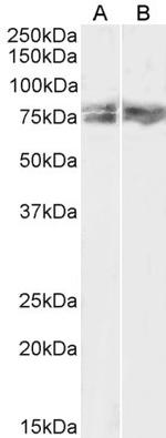 LIMK2 Antibody in Western Blot (WB)