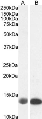 FABP1 Antibody in Western Blot (WB)