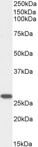 GSTM4 Antibody in Western Blot (WB)