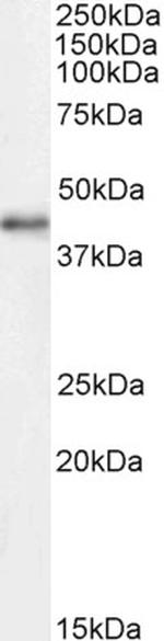 CDK9 Antibody in Western Blot (WB)