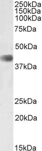 CDK9 Antibody in Western Blot (WB)