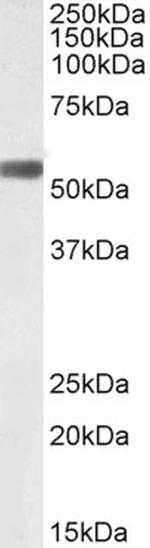 LAP (Latency Associated Peptide) Antibody in Western Blot (WB)