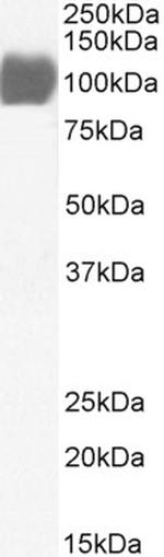 ACE2 Antibody in Western Blot (WB)