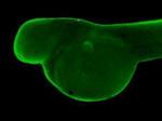 SMARCB1 Antibody in Immunohistochemistry (PFA fixed) (IHC (PFA))