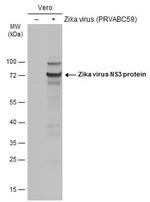 Zika Virus NS3 (strain H/PF/2013) Antibody in Western Blot (WB)