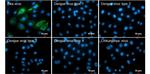 Zika Virus NS4B (strain H/PF/2013) Antibody in Immunocytochemistry (ICC/IF)