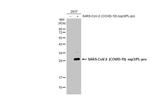 SARS-CoV-2 Nonstructural Protein 3 Antibody in Western Blot (WB)