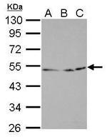 EGR2b Antibody in Western Blot (WB)