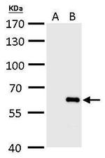 Influenza B NP (B/Taiwan/753/2005) Antibody in Western Blot (WB)