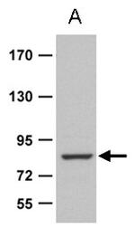 ZRANB1b Antibody in Western Blot (WB)