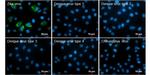 Zika Virus prM (strain H/PF/2013) Antibody in Immunocytochemistry (ICC/IF)