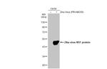 Zika Virus NS1 (strain H/PF/2013) Antibody in Western Blot (WB)