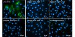 Zika Virus NS2B (strain H/PF/2013) Antibody in Immunocytochemistry (ICC/IF)