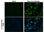 Zika Virus NS2B (strain H/PF/2013) Antibody in Immunocytochemistry (ICC/IF)