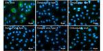 Zika Virus NS3 (strain H/PF/2013) Antibody in Immunocytochemistry (ICC/IF)