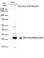 Zika Virus NS4B (strain H/PF/2013) Antibody in Western Blot (WB)