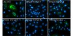 Zika Virus Capsid (strain H/PF/2013) Antibody in Immunocytochemistry (ICC/IF)