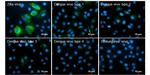 Zika Virus Envelope (strain H/PF/2013) Antibody in Immunocytochemistry (ICC/IF)