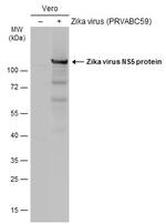 Zika Virus NS5 (strain H/PF/2013) Antibody in Western Blot (WB)