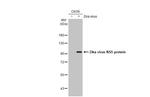 Zika Virus NS5 (strain H/PF/2013) Antibody in Western Blot (WB)