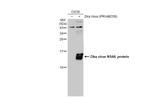 Zika Virus NS4A (strain H/PF/2013) Antibody in Western Blot (WB)