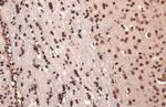 FOXP2 Antibody in Immunohistochemistry (Paraffin) (IHC (P))